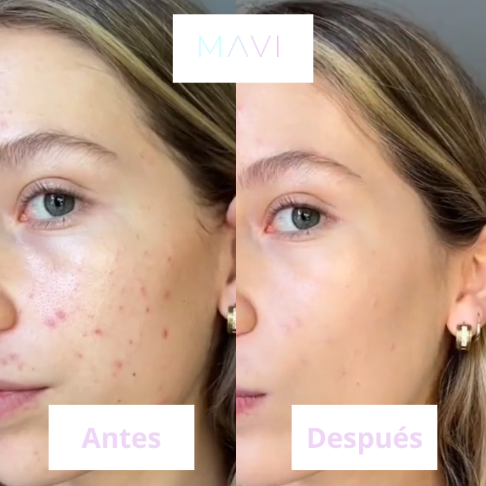 BB Cream - Base Maquillaje Hidratante